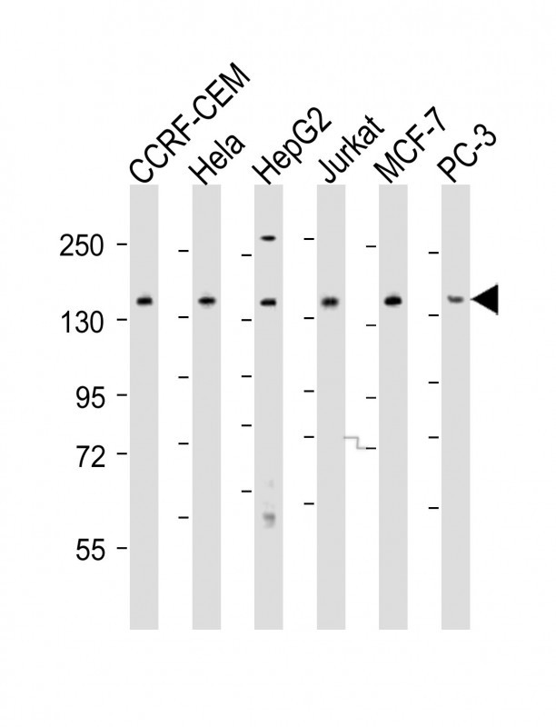 WB - PLCG1 Antibody (Center) AP21509c
